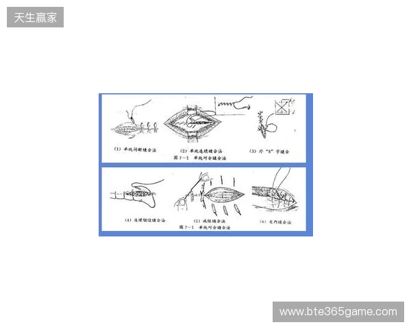 广州豹官方:杨浩眉弓伤口缝合30余针,预计5-7天后拆线 广州豹官方:杨浩眉弓伤口缝合30余针,预计5-7天后拆线